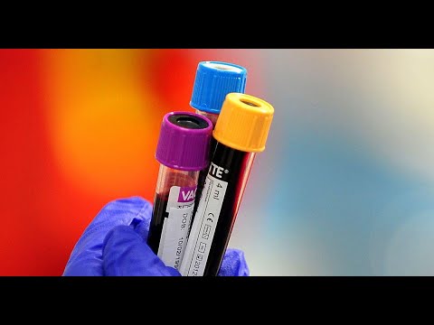 Revolutionary Blood Test: Transforming Cancer Detection by 2035